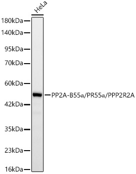 PP2A-B55α/PR55α/PPP2R2A Rabbit mAb