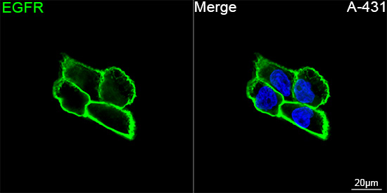 ABflo® 488 Rabbit anti-Human EGFR mAb