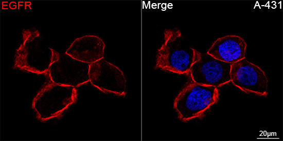 ABflo® 647 Rabbit anti-Human EGFR mAb