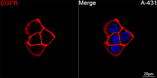 ABflo® 594 Rabbit anti-Human EGFR mAb