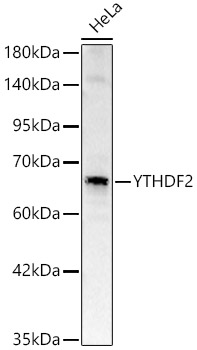 YTHDF2 Rabbit pAb