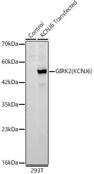 GIRK2(KCNJ6) Rabbit mAb