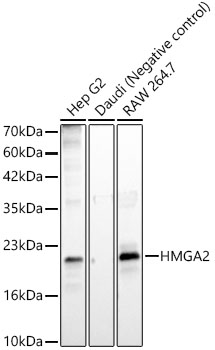 HMGA2 Rabbit mAb