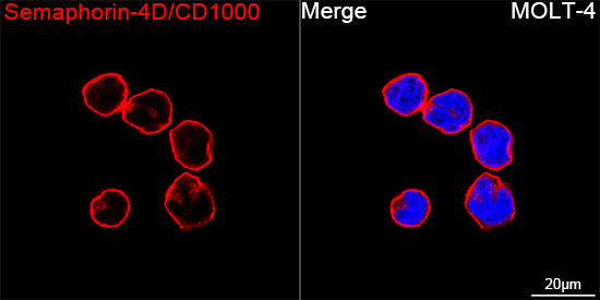 Semaphorin-4D/CD100 Rabbit mAb