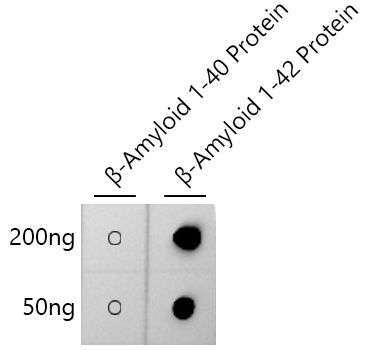 β-Amyloid(1-42) Rabbit mAb