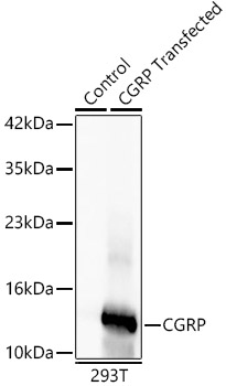 CGRP Rabbit mAb