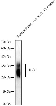 IL-31 Rabbit mAb