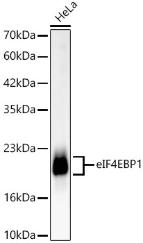 eIF4EBP1 Rabbit mAb