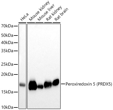 Peroxiredoxin 5 (PRDX5) Rabbit mAb