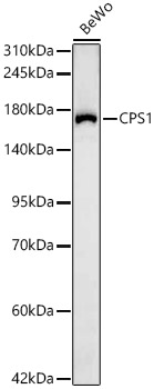 CPS1 Rabbit mAb