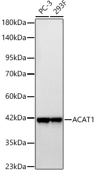 ACAT1 Rabbit mAb