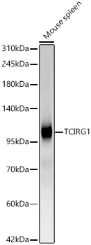 TCIRG1 Rabbit mAb