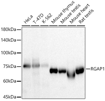 [KD Validated] RGAP1 Rabbit mAb