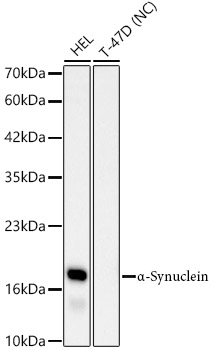 α-Synuclein Rabbit mAb