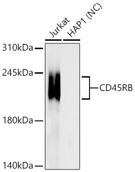 CD45RB Rabbit mAb