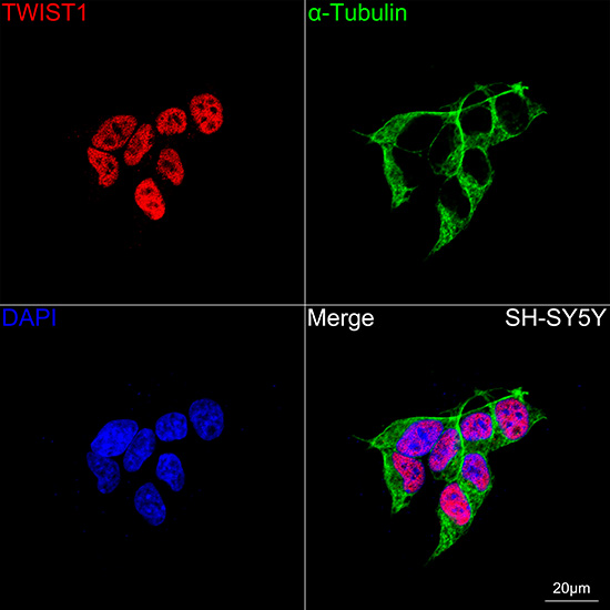 TWIST1 Rabbit mAb