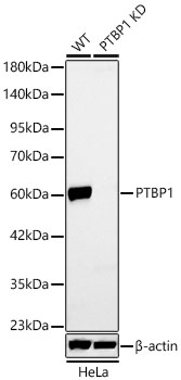 [KD Validated] PTBP1 Rabbit mAb