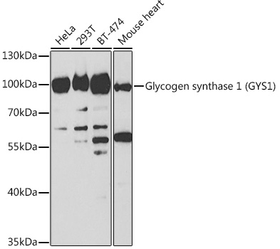 Glycogen synthase 1 (GYS1) Rabbit pAb