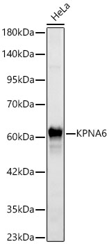 KPNA6 Rabbit PolymAb®