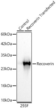 Recoverin Rabbit mAb