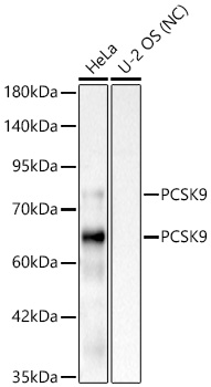 PCSK9 Rabbit mAb