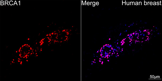 BRCA1 Rabbit mAb-Monoclonal Antibodies - ABclonal/拜爾國際(BioAb)