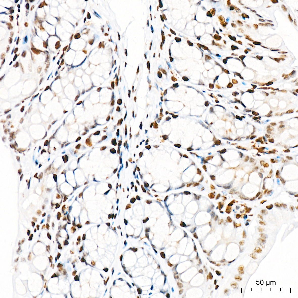 BRCA1 Rabbit mAb-Monoclonal Antibodies - ABclonal/拜爾國際(BioAb)