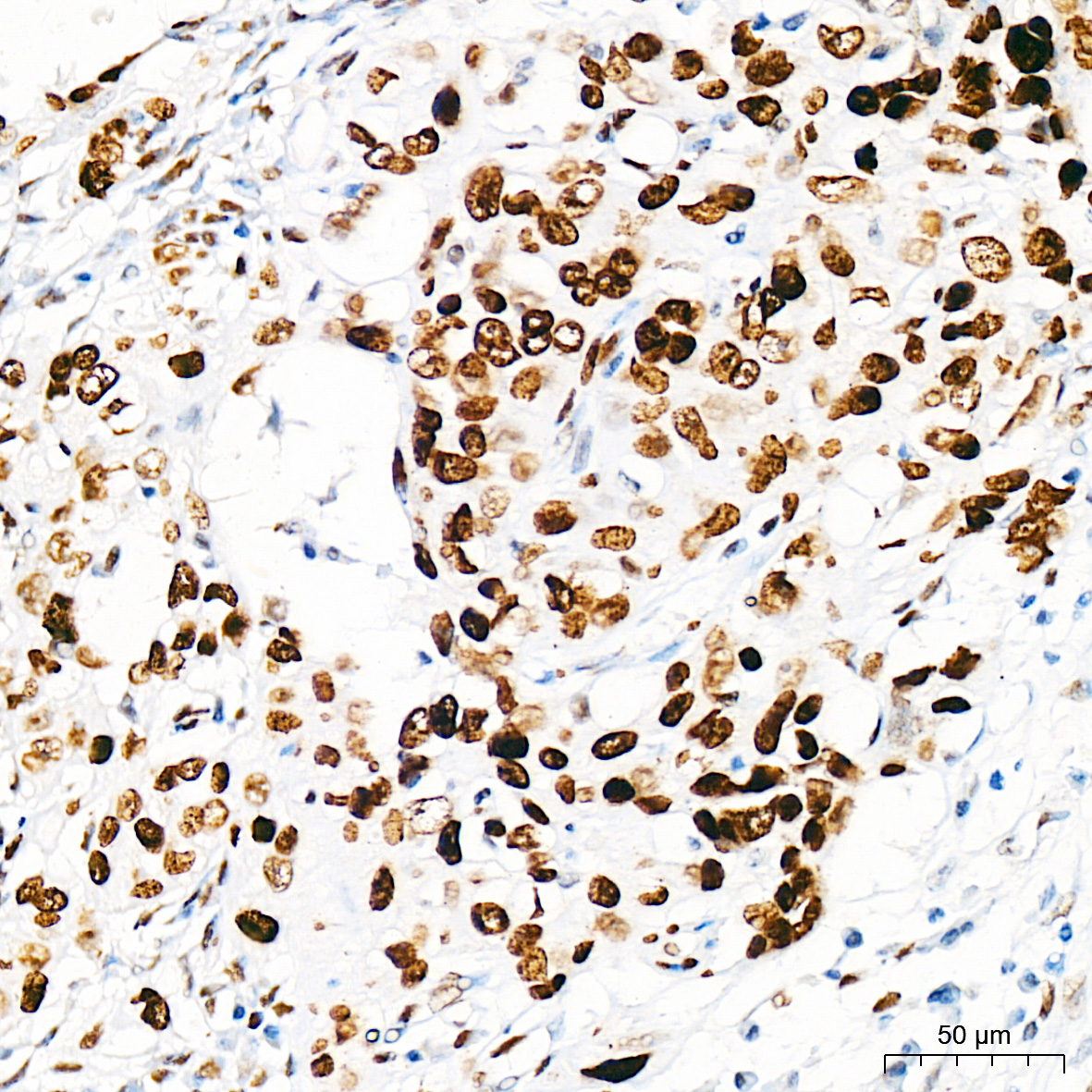 BRCA1 Rabbit mAb-Monoclonal Antibodies - ABclonal/拜爾國際(BioAb)