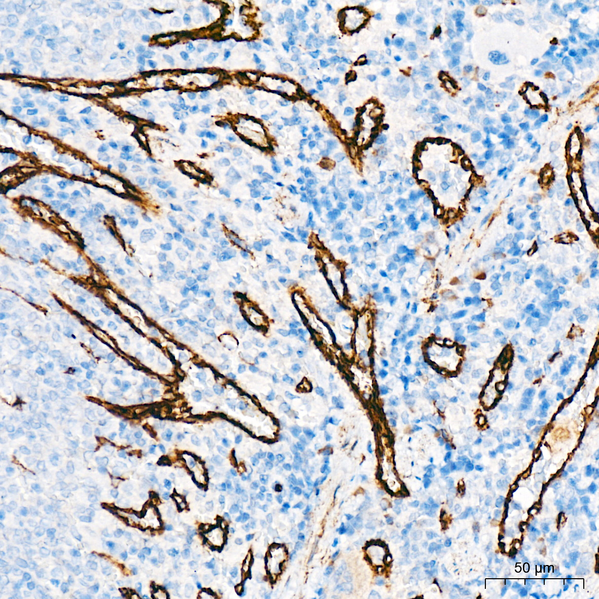 ZO-1 Rabbit mAb