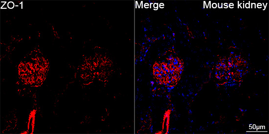 ZO-1 Rabbit mAb