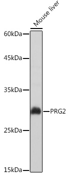 PRG2 Rabbit pAb