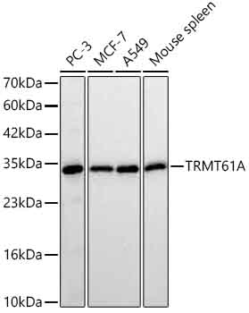 TRMT61A Rabbit mAb