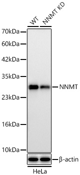 [KD Validated] NNMT Rabbit mAb