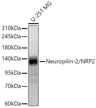 Neuropilin-2/NRP2 Rabbit mAb