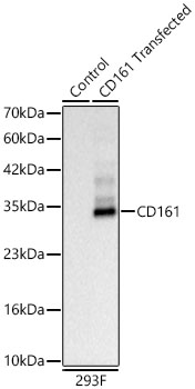 CD161 Rabbit mAb