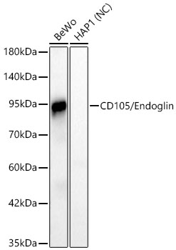 CD105/Endoglin Rabbit mAb