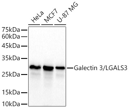 Galectin 3/LGALS3 Rabbit mAb