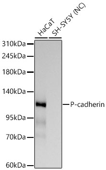 P-cadherin Rabbit mAb