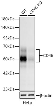 [KD Validated] CD46 Rabbit mAb