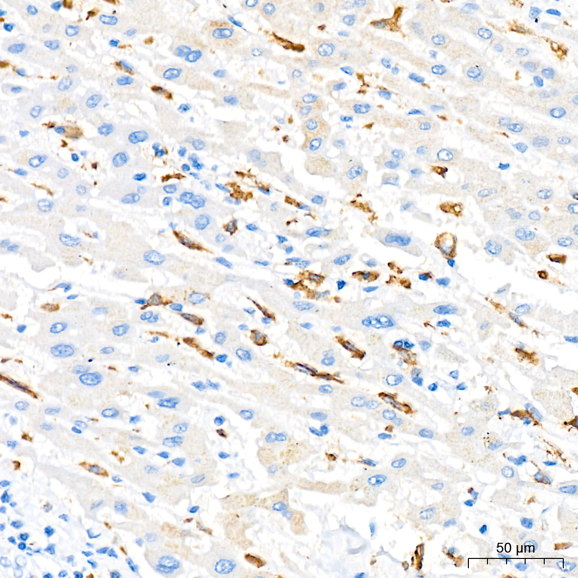 CD204 Rabbit mAb