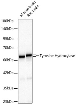 Tyrosine Hydroxylase Rabbit mAb