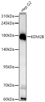 [KD Validated] KDM2B Rabbit pAb