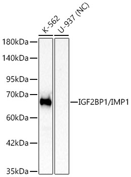 IGF2BP1/IMP1 Rabbit mAb