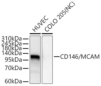 CD146/MCAM Rabbit mAb