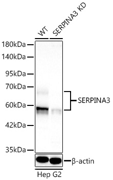 [KD Validated] SERPINA3 Rabbit pAb