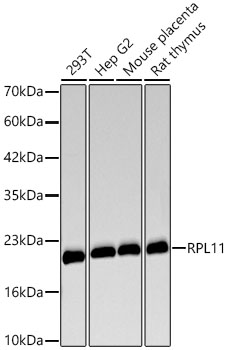 RPL11 Rabbit mAb