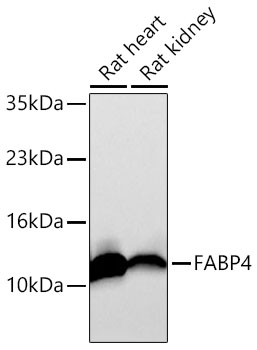 FABP4 Rabbit mAb