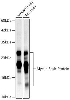 Myelin Basic Protein Rabbit mAb