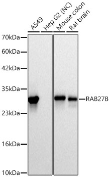 RAB27B Rabbit mAb