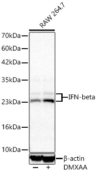 IFN-beta Rabbit mAb